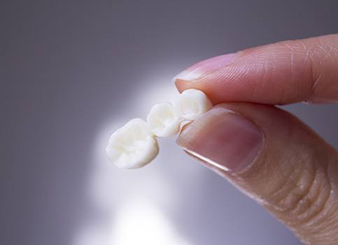 Person holding a dental bridge